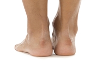 Types and Causes of Foot Deformities