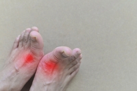 Managing Gout