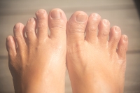 Recognizing the Effects of Splayfoot