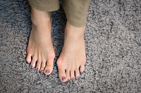 Bunion Exercises and When to Consult a Podiatrist