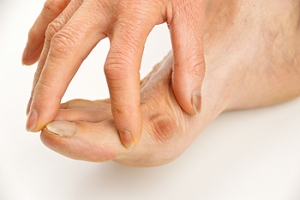 Symptoms of Bunions in Children